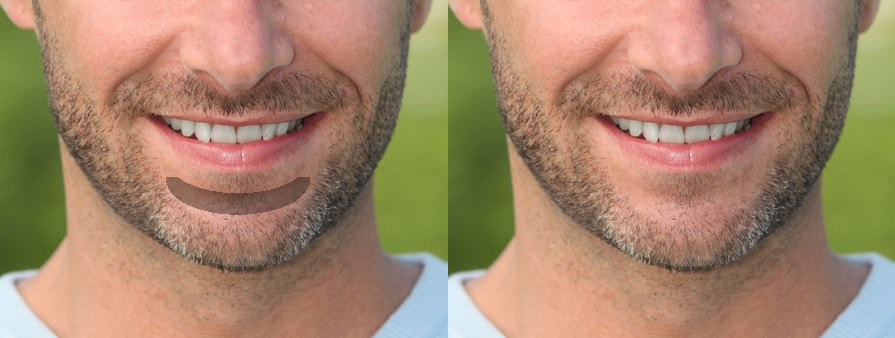 La barbe de 3 jours - Taille et Entretien